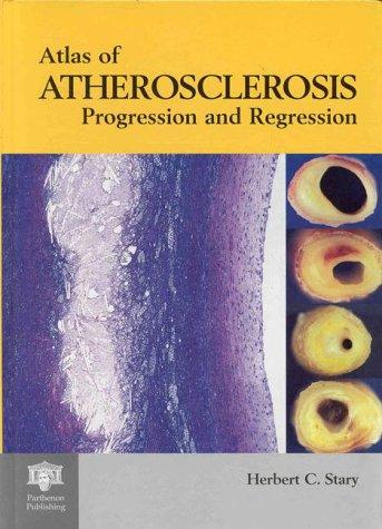 An Atlas of Atherosclerosis Progression and Regression