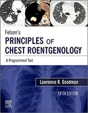 Felson's Principles of Chest Roentgenology
