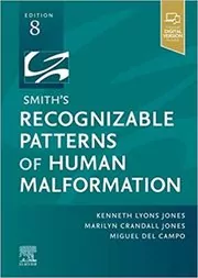 Smith's Recognizable Patterns of Human Malformation