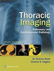 Thoracic Imaging
